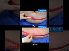 ফ্রিজ ফ্যাট, ১ ঘণ্টায় ৪ সেন্টিমিটার হারাবে!