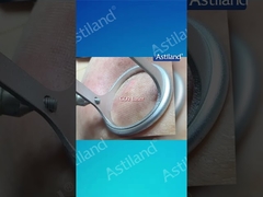 এইচআইএফইউ বনাম সিও২ লেজার, আপনি কোন অ্যান্টি-এজিং ট্রিটমেন্ট পছন্দ করেন?