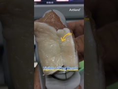 আসুন HIFU এর তাত্ক্ষণিক উত্তোলন প্রভাব পরীক্ষা করা যাক